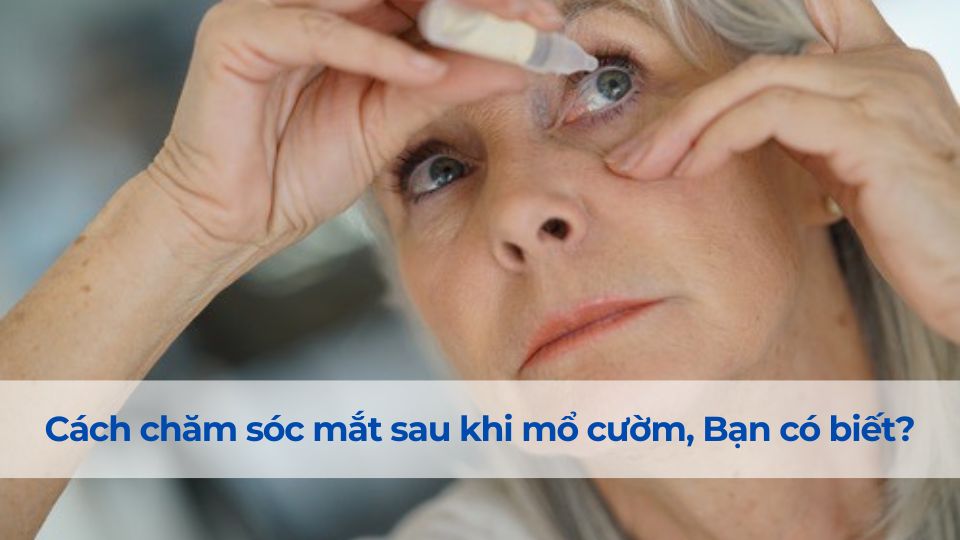 cham-soc-mat-sau-khi-mo-cuom