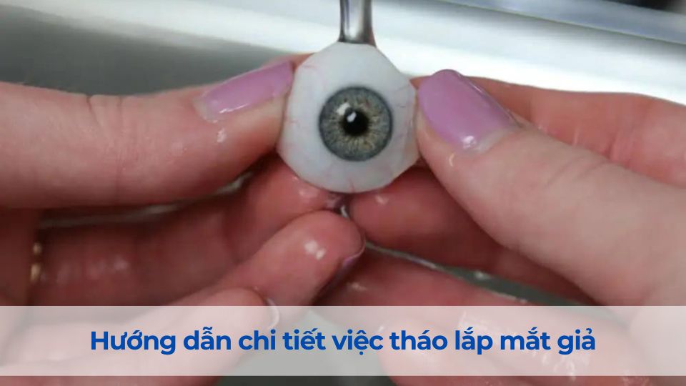 Hướng dẫn chi tiết việc tháo lắp mắt giả