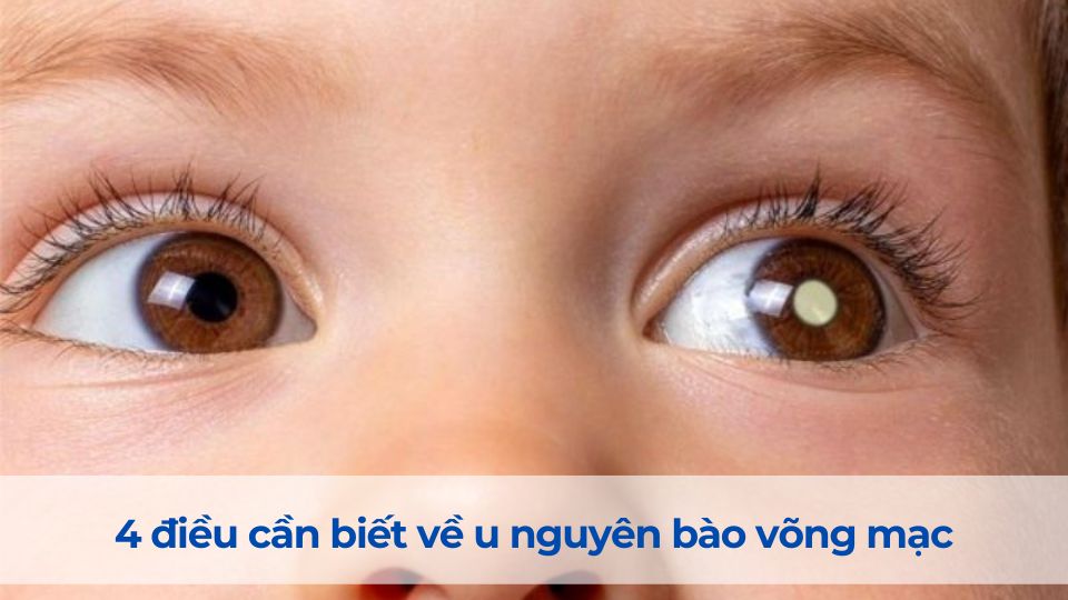 u-nguyen-bao-vong-mac