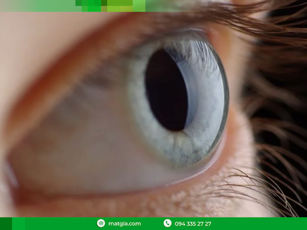 Chấn thương vỡ nhãn cầu mắt phải làm sao - Trung tâm Mắt giả Việt Nam Matgia.com