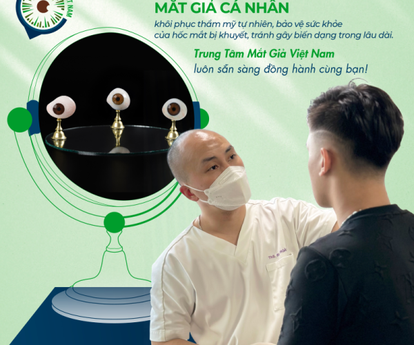 Thay mắt giả mất bao lâu - Matgia.com