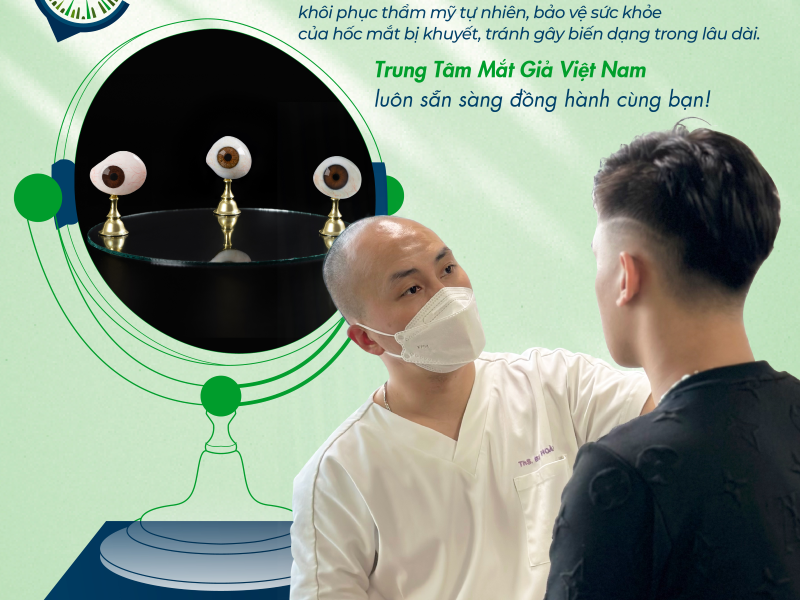 Thay mắt giả mất bao lâu - Matgia.com