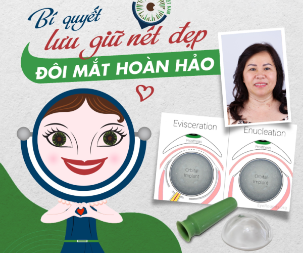 conformer là gì với phẫu thuật múc bỏ nhãn cầu - Matgia.com