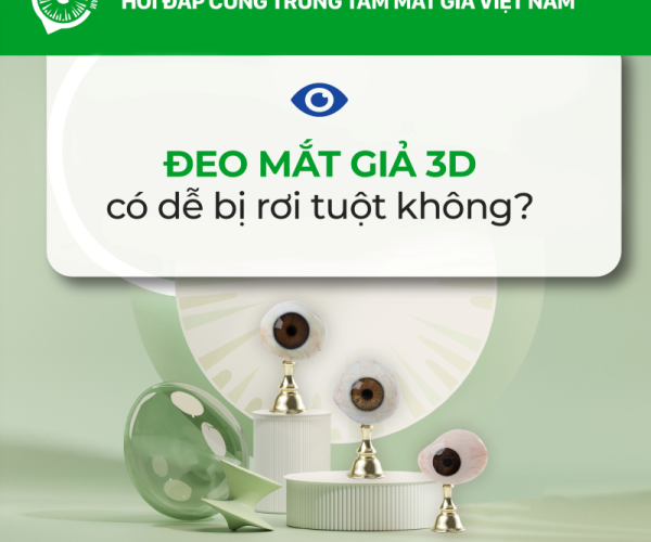 Đeo mắt giả có bị rơi ra ngoài không - Matgia.com