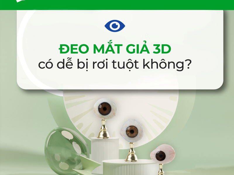 Đeo mắt giả có bị rơi ra ngoài không - Matgia.com