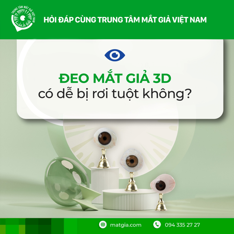Đeo mắt giả có bị rơi ra ngoài không - Matgia.com