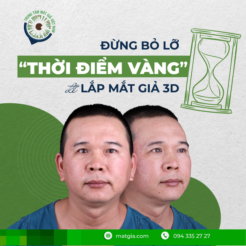 Khi nào nên lắp mắt giả - Matgia.com