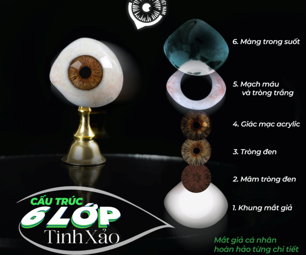 Mắt giả có cấu tạo như thế nào - Matgia.com