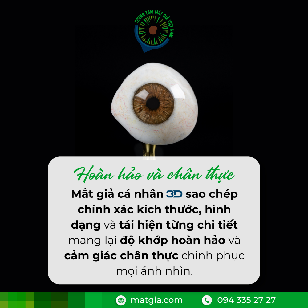 Nên lắp mắt giả cá nhân khi nào - Matgia.com