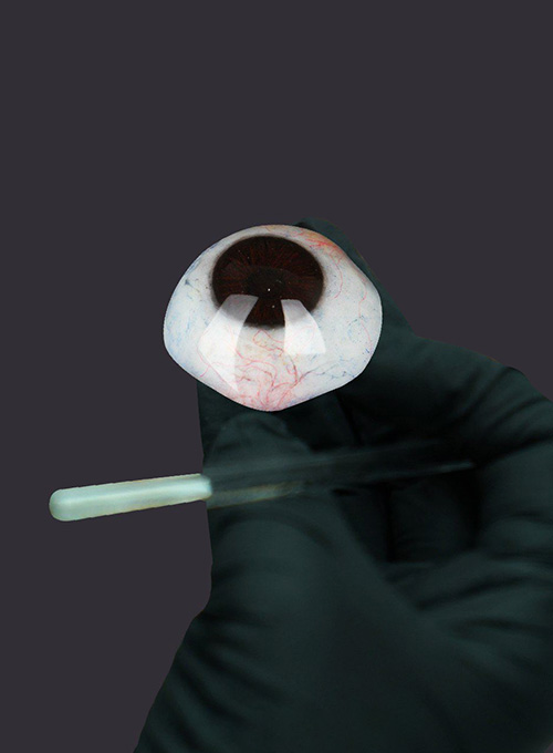 Chế tác mắt giả cá nhân 3D theo đặc điểm riêng của từng khách hàng - Trung Tâm Mắt Giả Việt Nam