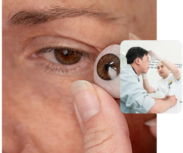 So sánh mắt giả cá nhân 3D và mắt giả thông thường - Trung Tâm Mắt Giả Việt Nam