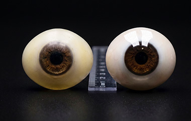 Prosthetic Eye Replacement
