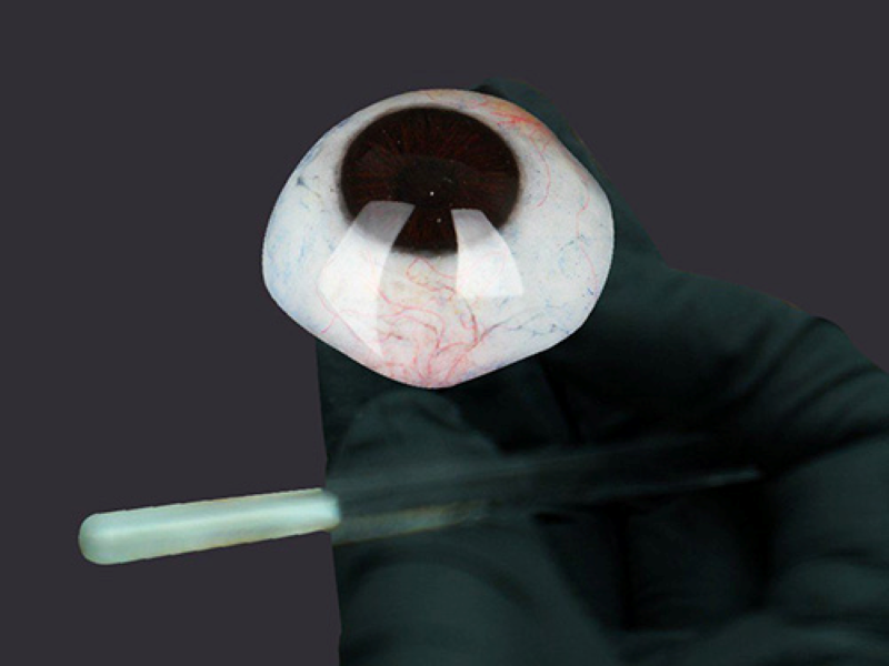Mắt giả công nghệ cao - mắt giả 3D sống động như mắt thật