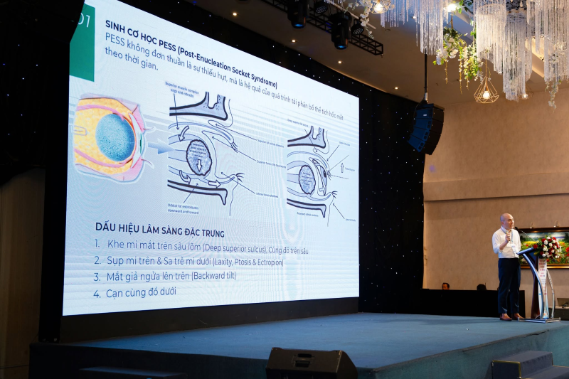 Báo cáo khoa học về mắt giả cá nhân 3D và tái tạo hốc mắt tại hội nghị nhãn khoa